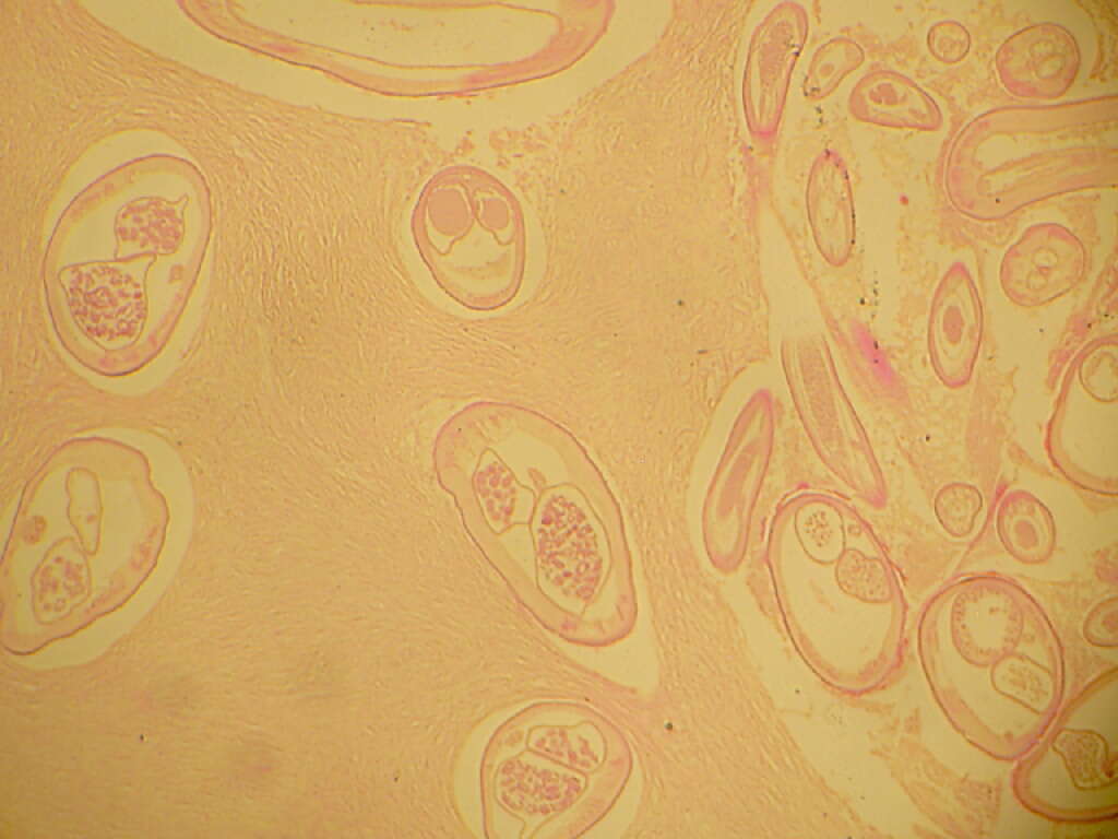 Image of <i>Onchocerca volvulus</i>