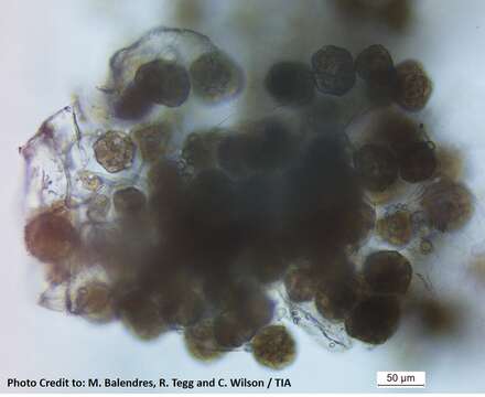 Spongospora subterranea resmi