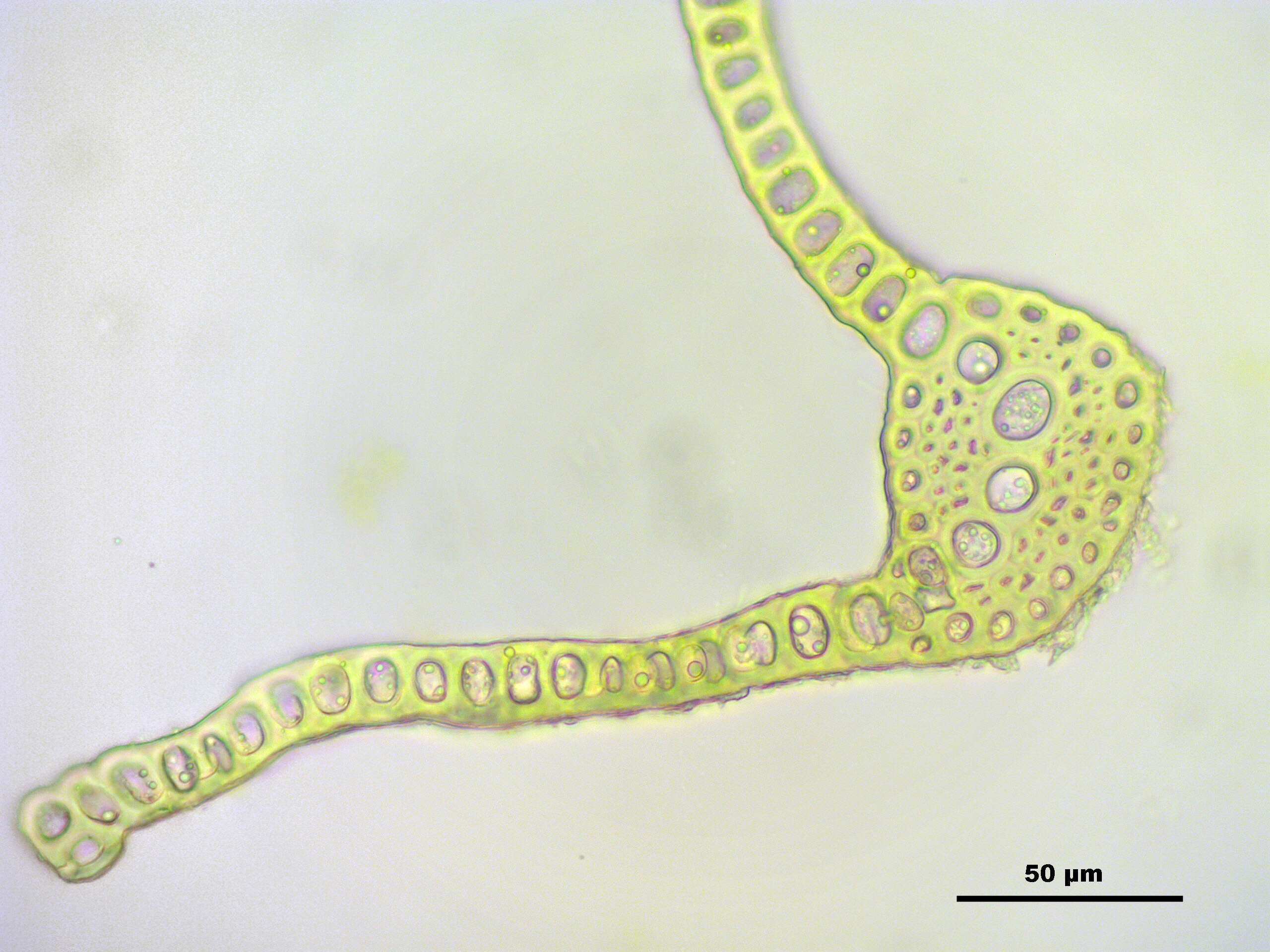 Image of oncophorus moss