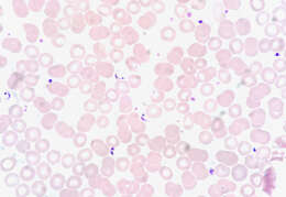 Image of Trypanosoma subgen. Schizotrypanum