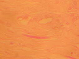 Imagem de <i>Onchocerca volvulus</i>