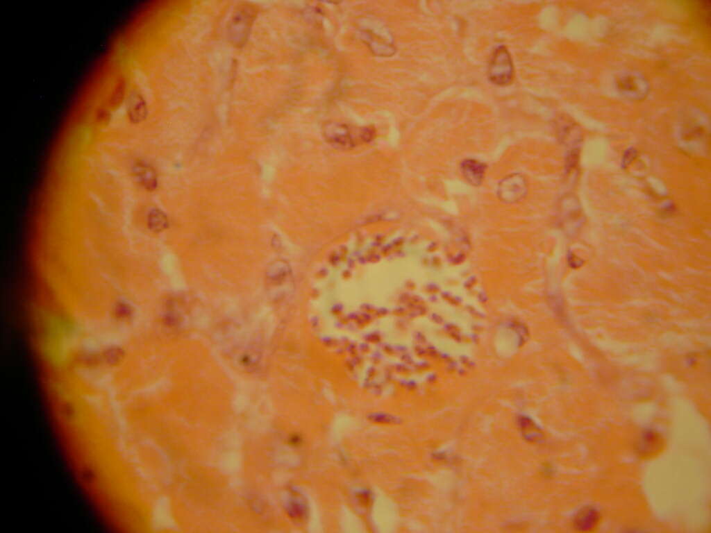 Слика од Trypanosoma subgen. Schizotrypanum