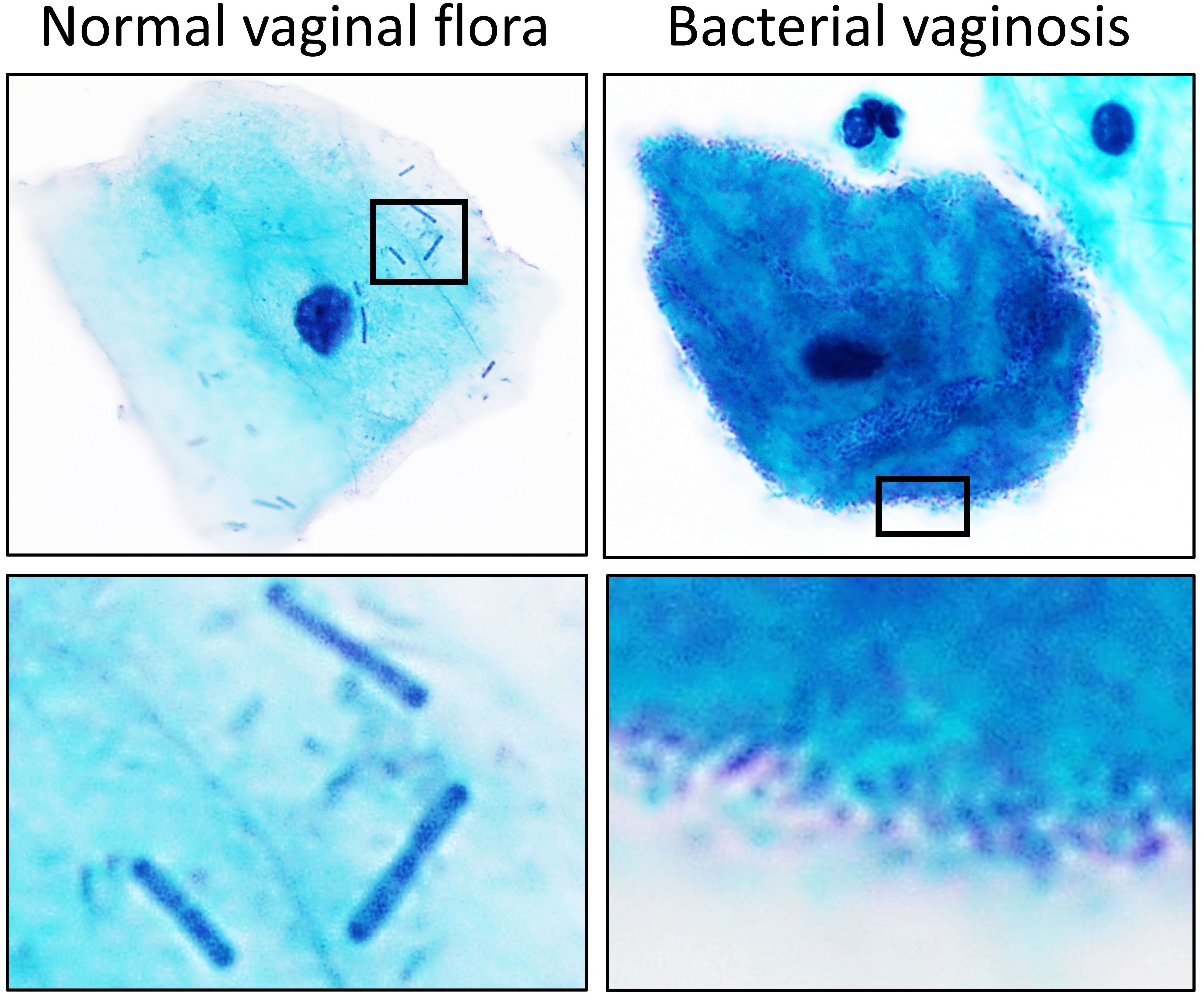 Image of Lactobacillaceae