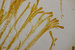 Image of Byssonectria fusispora (Berk.) Rogerson & Korf 1971