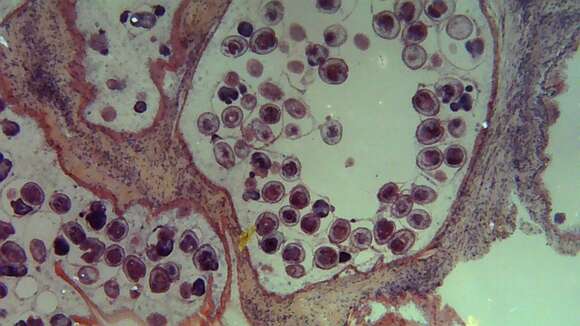 Imagem de Echinococcus