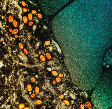 Image of Monkeypox virus