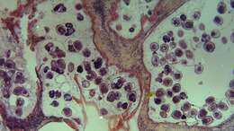 Image of Echinococcus