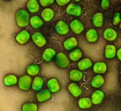 Image of Monkeypox virus