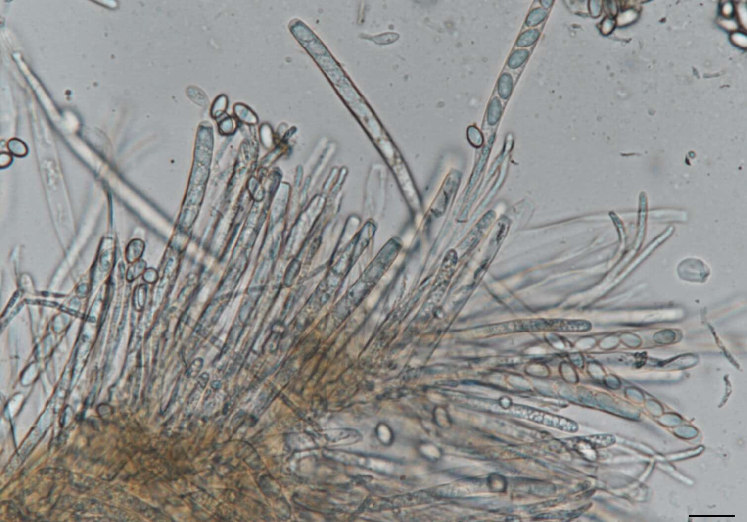 Image of Sclerotinia sclerotiorum (Lib.) de Bary 1884