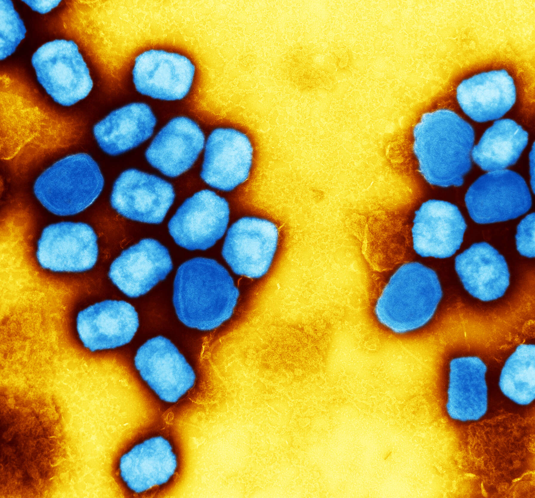 Image of Monkeypox virus