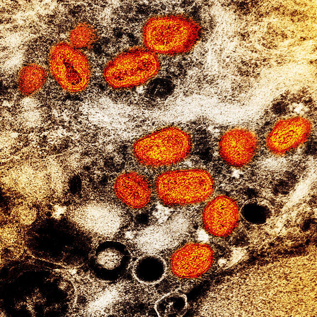 Image of Monkeypox virus