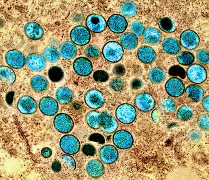 Image of Monkeypox virus