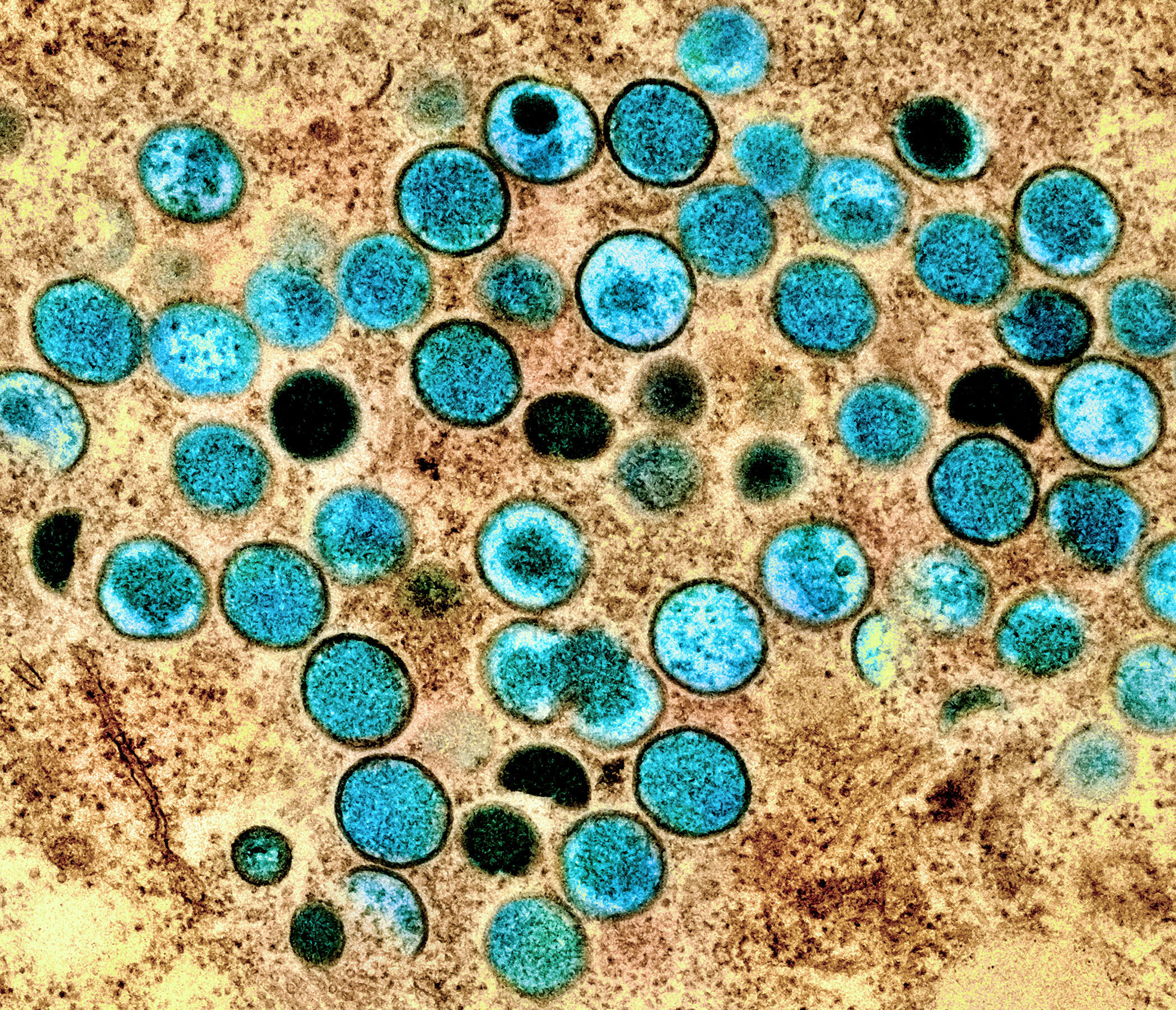 Sivun Monkeypox virus kuva