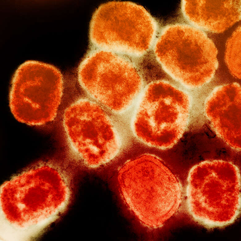 Image of Monkeypox virus