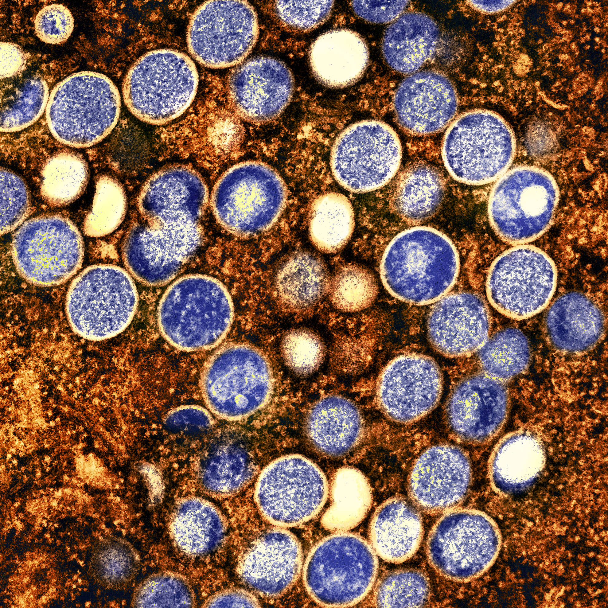 Image of Monkeypox virus