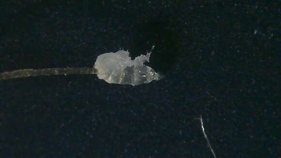 Image of Follicle mites