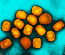 Image of Monkeypox virus