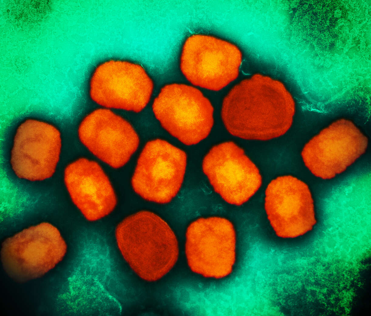 Image of Monkeypox virus