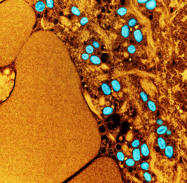 Image of Monkeypox virus