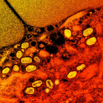 Image of Monkeypox virus