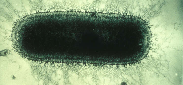 Image of Rabies virus