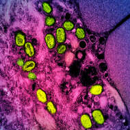 Image of Monkeypox virus