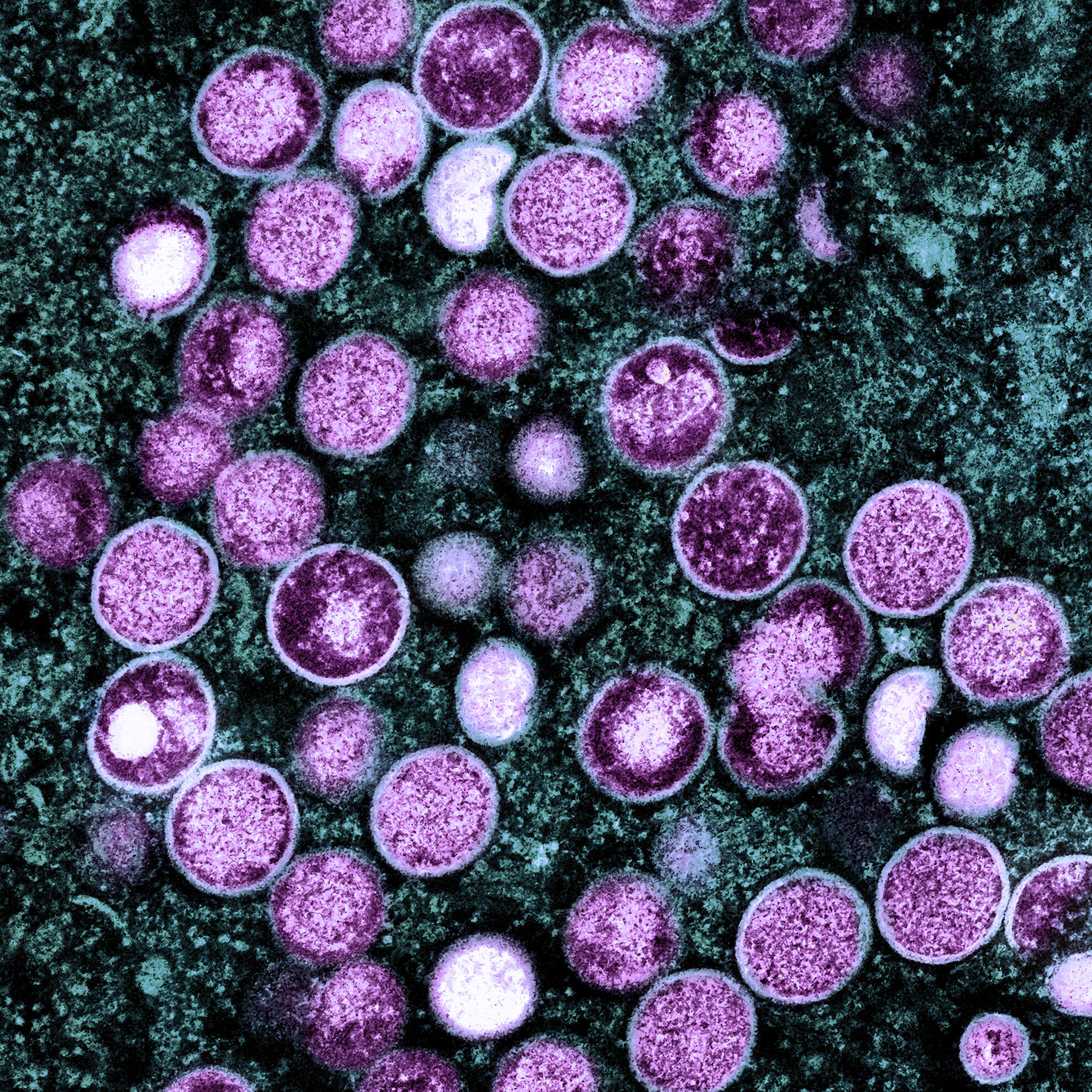Image of Monkeypox virus