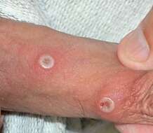 Image de Monkeypox virus