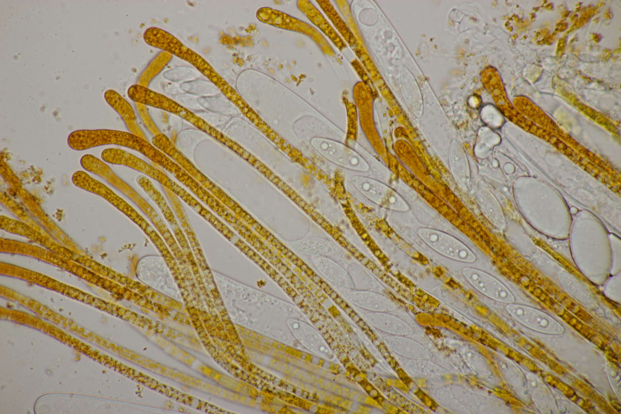 Слика од Byssonectria fusispora (Berk.) Rogerson & Korf 1971