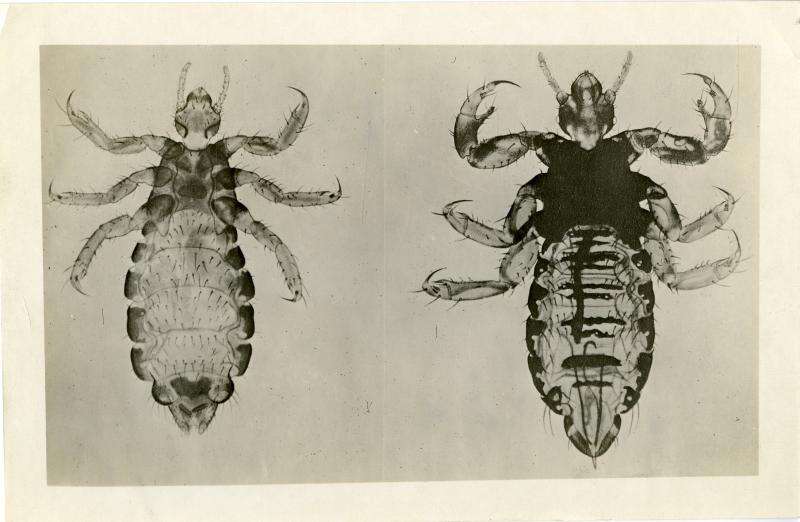 Image of Body Louse