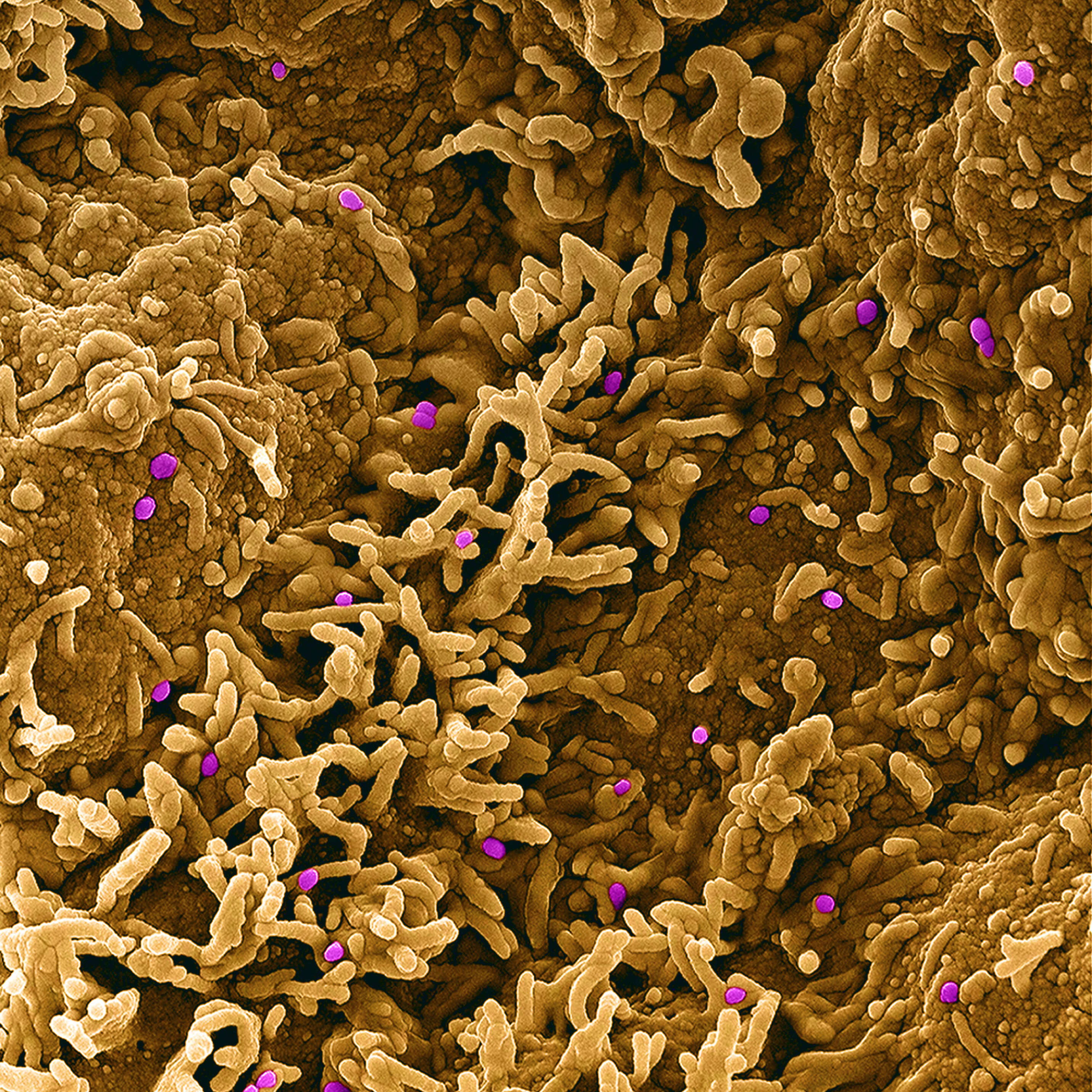 صورة فيروس جدري النسناس