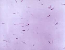 Image of Clostridium tetani