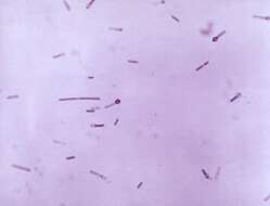 Imagem de Clostridium tetani