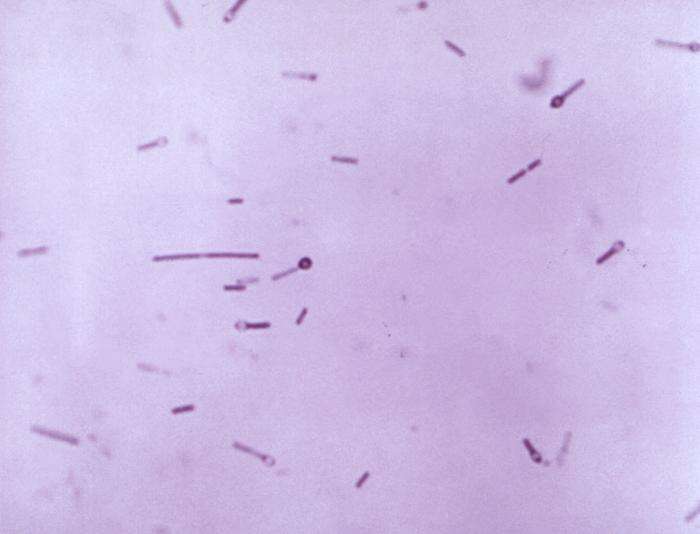 Imagem de Clostridium tetani