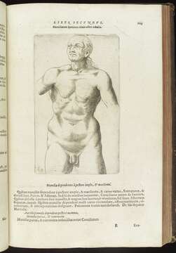 Image of Homo Linnaeus 1758