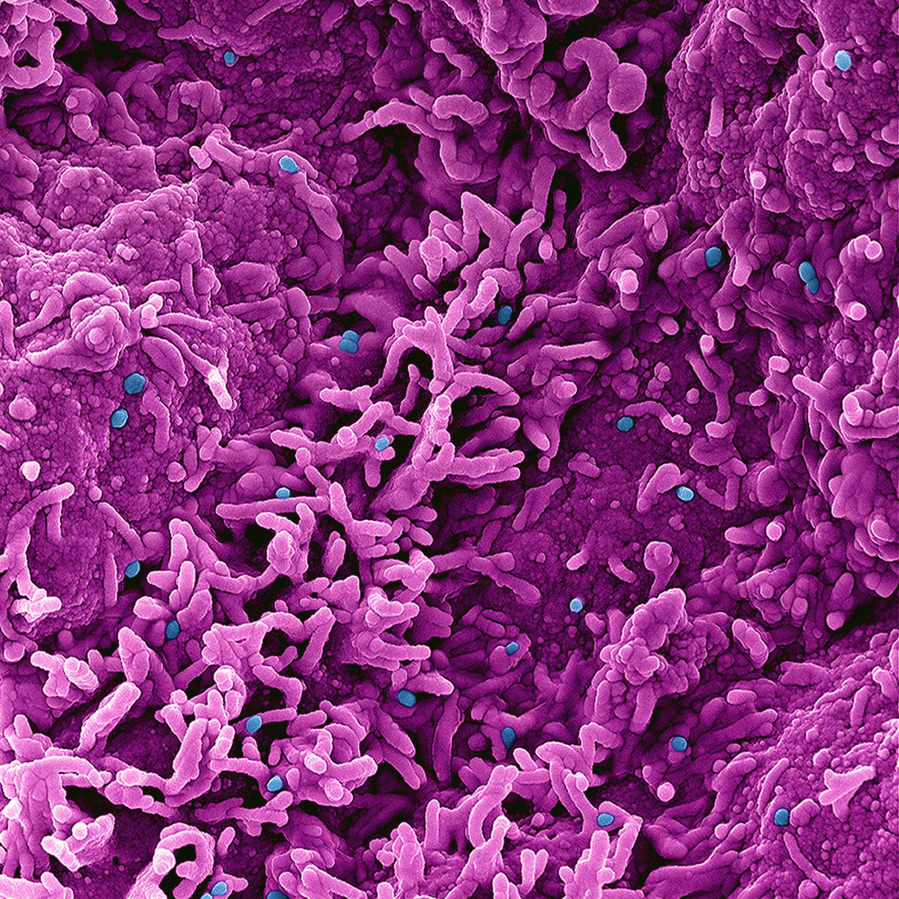 صورة فيروس جدري النسناس