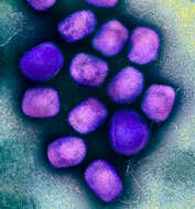 Image of Monkeypox virus