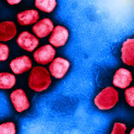 Image of Monkeypox virus