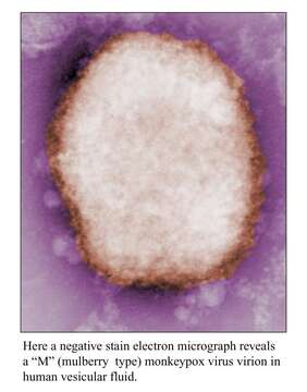 Image of Monkeypox virus