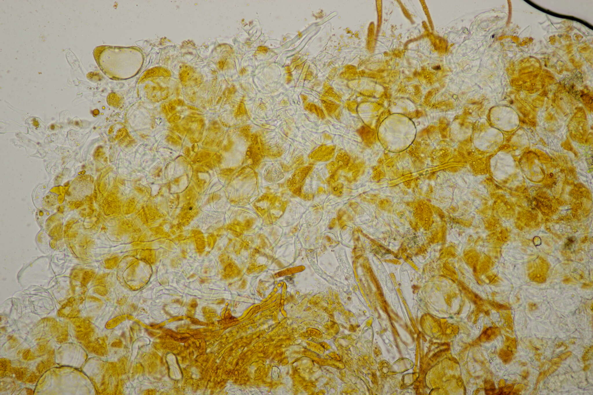 Image of Byssonectria fusispora (Berk.) Rogerson & Korf 1971