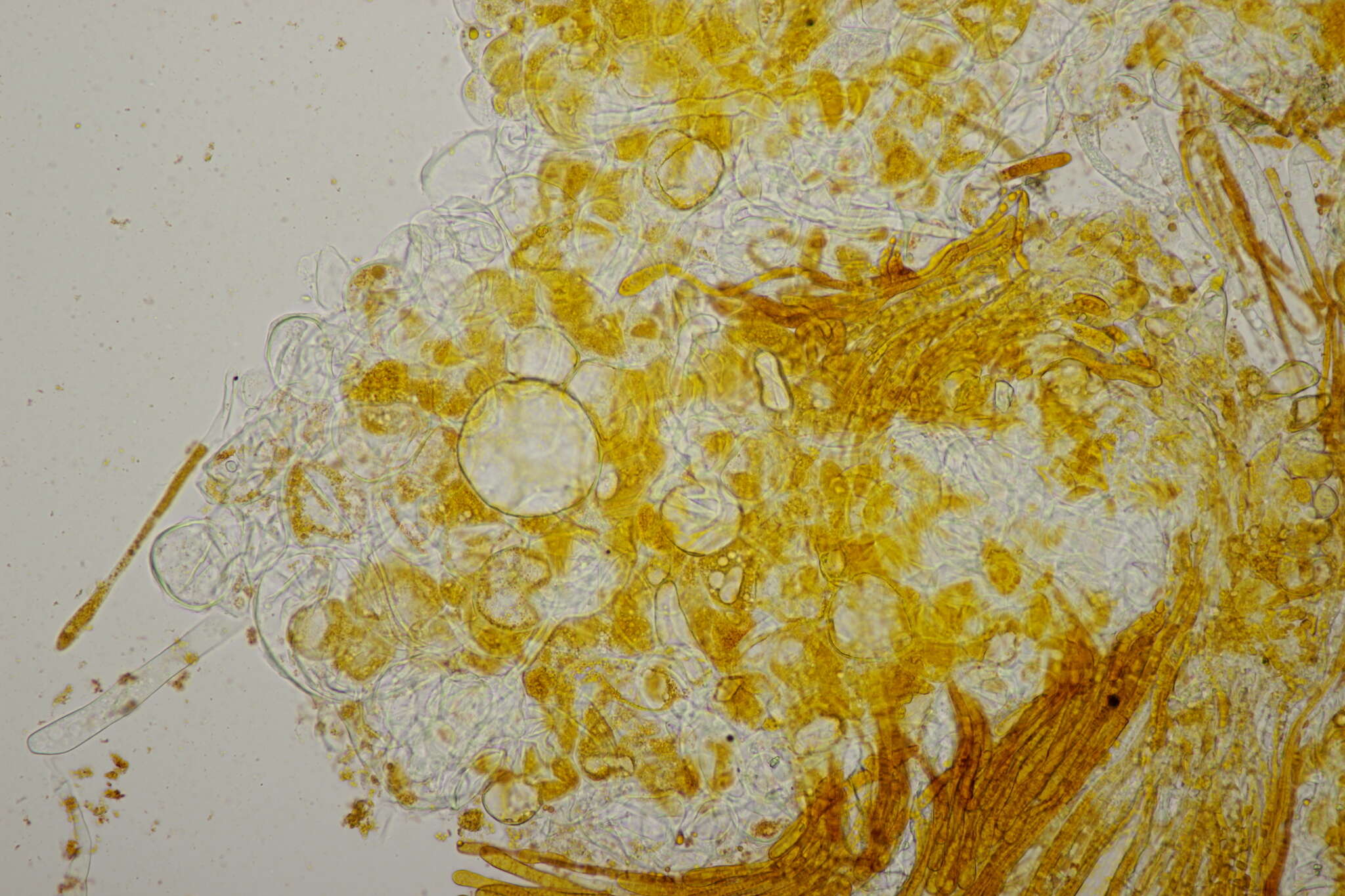 Image of Byssonectria fusispora (Berk.) Rogerson & Korf 1971