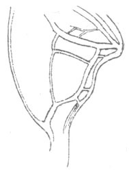 Image of Thin-footed Thread-legged Katydid