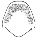 Image of Caudell's Conehead