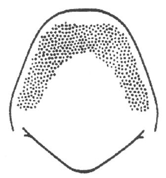 Image of Caudell's Conehead