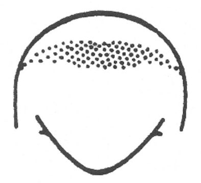 Image of Round-tipped Conehead