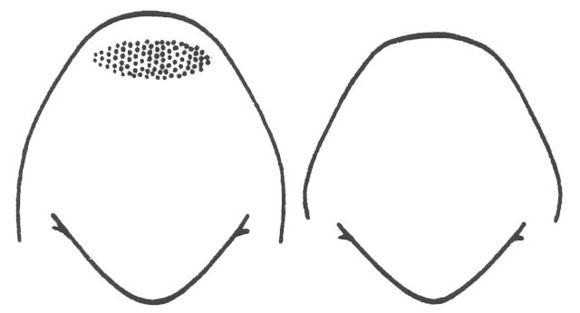 Image de Neoconocephalus robustus (Scudder & S. H. 1862)