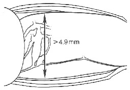 Image de Neoconocephalus robustus (Scudder & S. H. 1862)