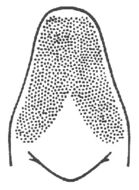 Image of Nebraska Conehead
