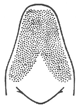 Image of Nebraska Conehead