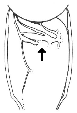 Слика од Neoconocephalus lyristes (Rehn, J. A. G. & Hebard 1905)